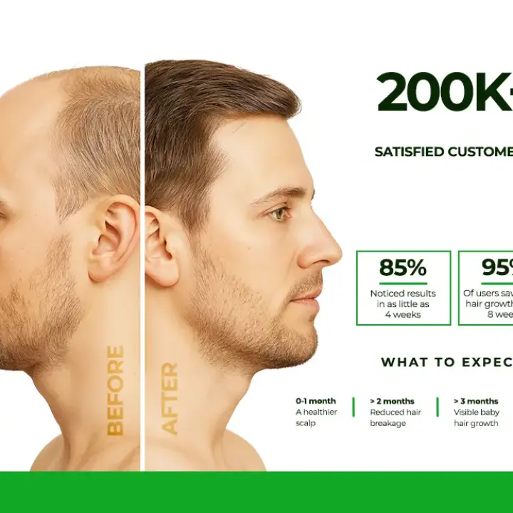 Neo Hair Lotion Thailand Original